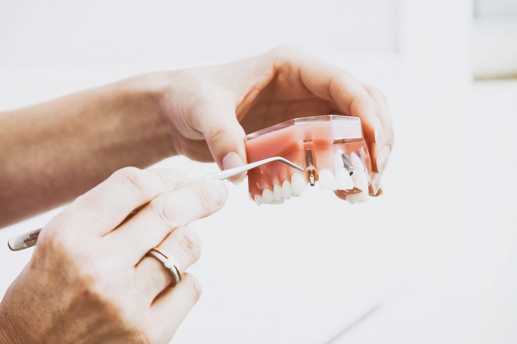 Dentista mostrando un modelo dental